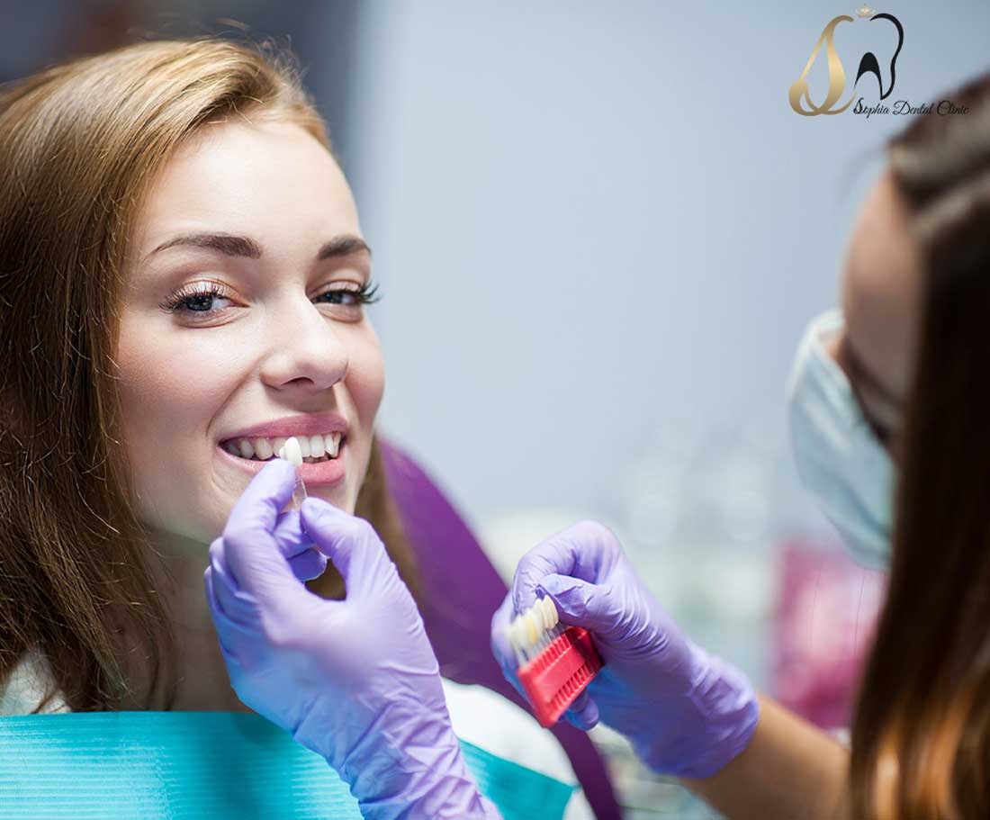 لمینت در یافت آباد