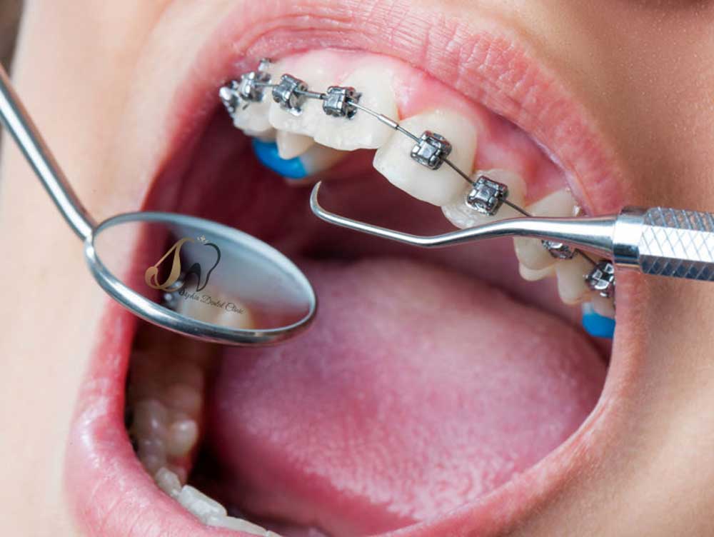 ارتودنسی در دندانپزشکی یافت آباد
