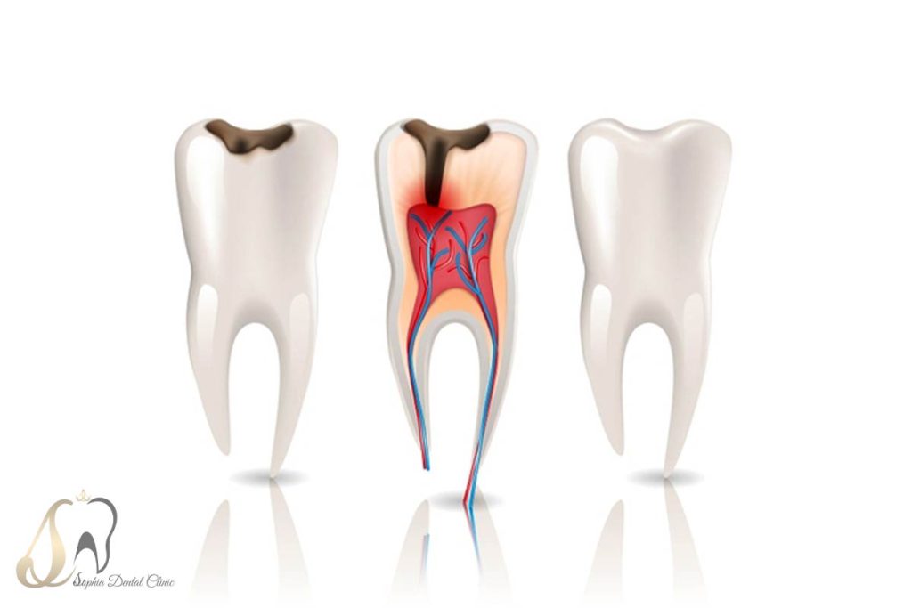 عصب کشی یافت آباد