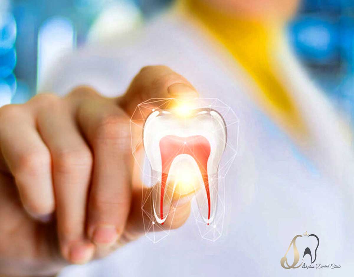 عصب کشی در یافت آباد