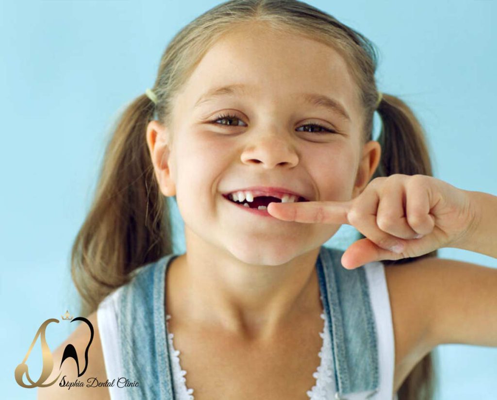 نحوه کشیدن دندان شیری