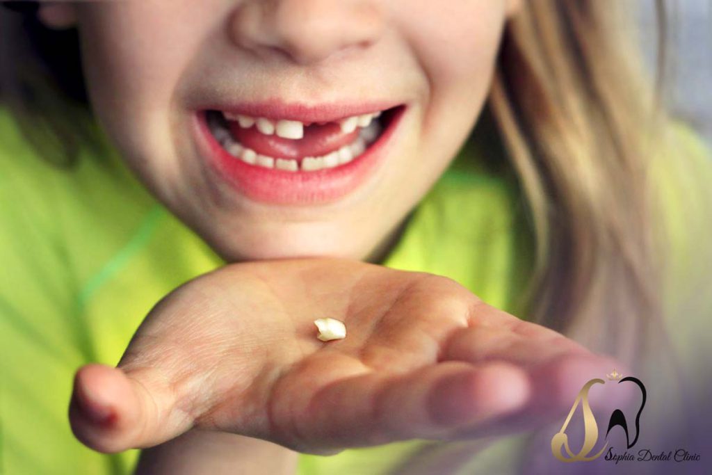 روش کشیدن دندان شیری کودکان