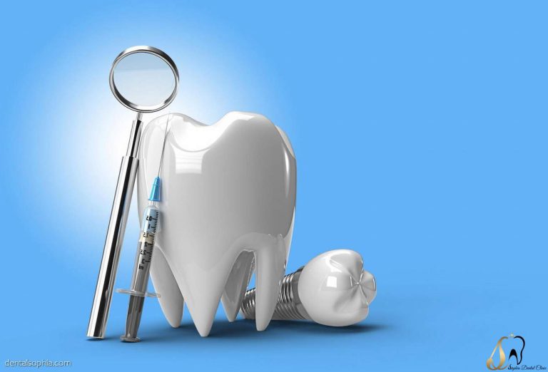 مراقبت های مهم کاشت دندان