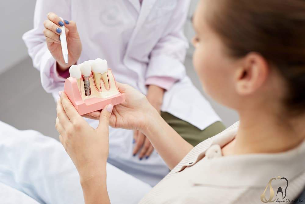 ایمپلنت چیست و مزایای آن