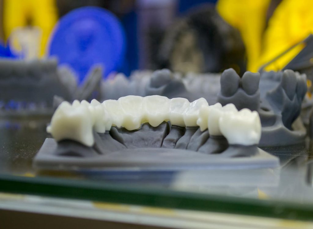 چاپ سه بعدی دندان