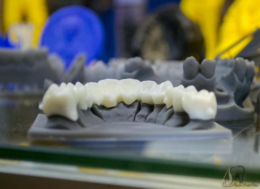 چاپ سه‌بعدی دندان