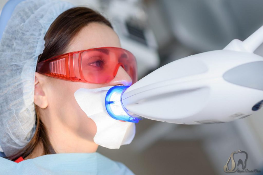 مزایای لیزر دندانپزشکی