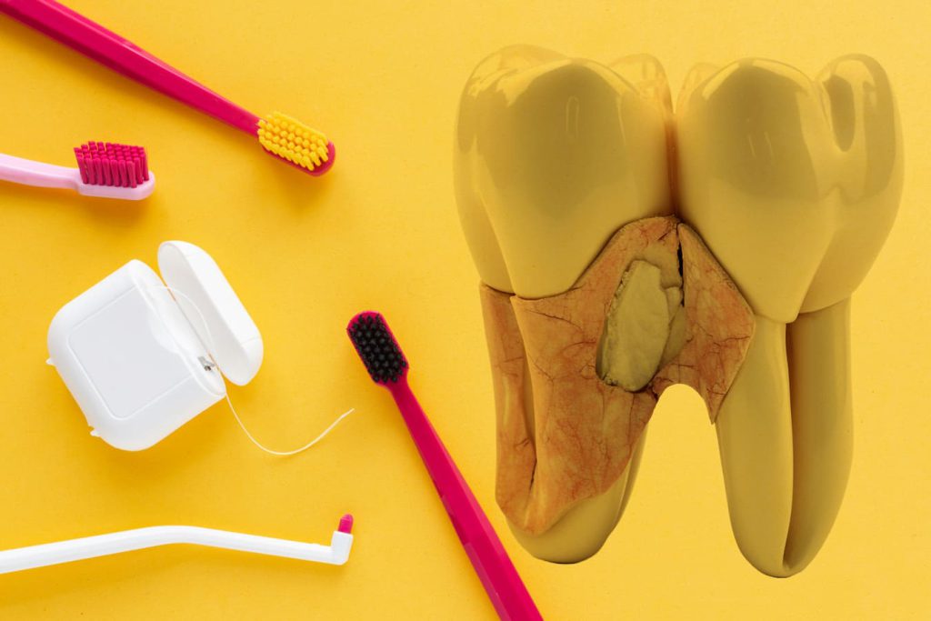 مراقبت‌های بعد از عصب کشی