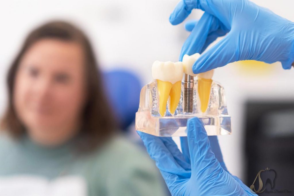 جراحی ایمپلنت دندان