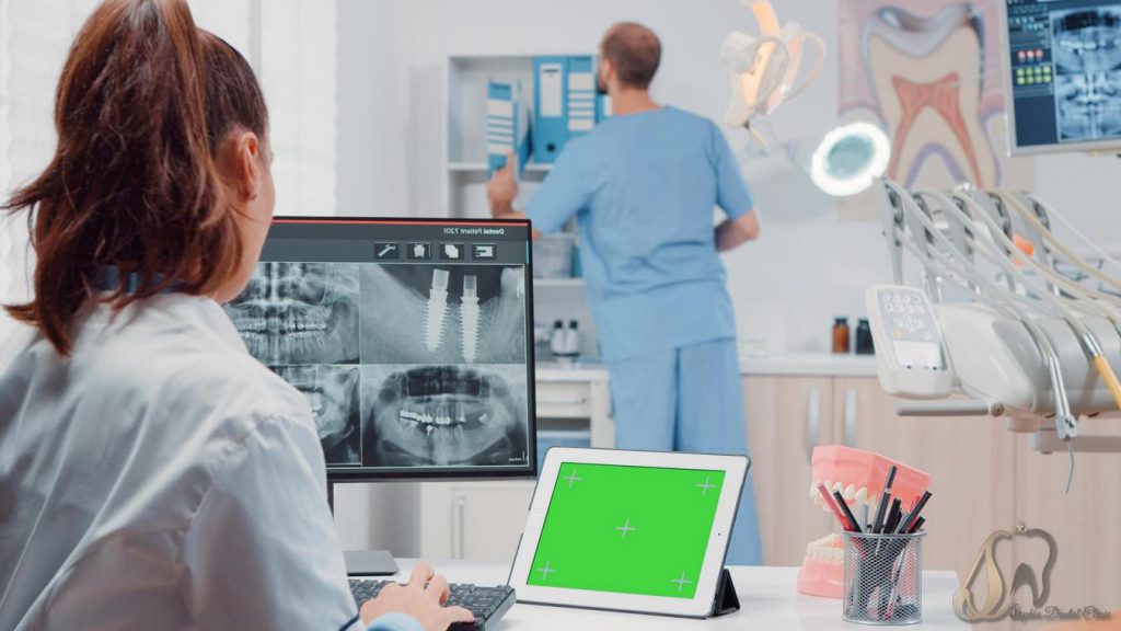 فاکتورهای مهم در انتخاب ایمپلنت