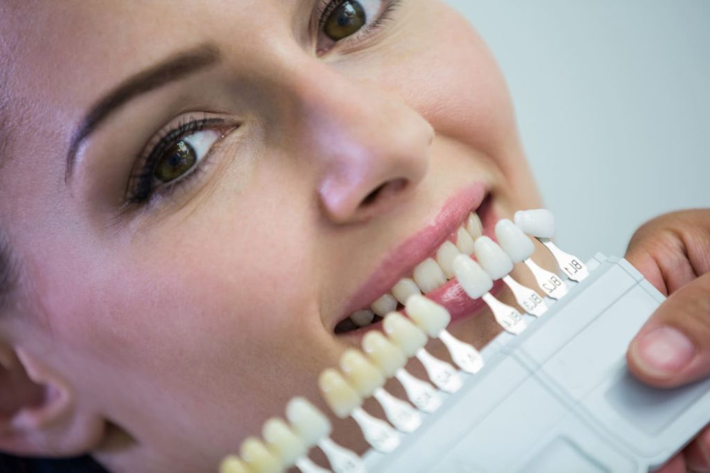 لمینت‌های دندانی نامناسب دندانپزشکی سوفیا