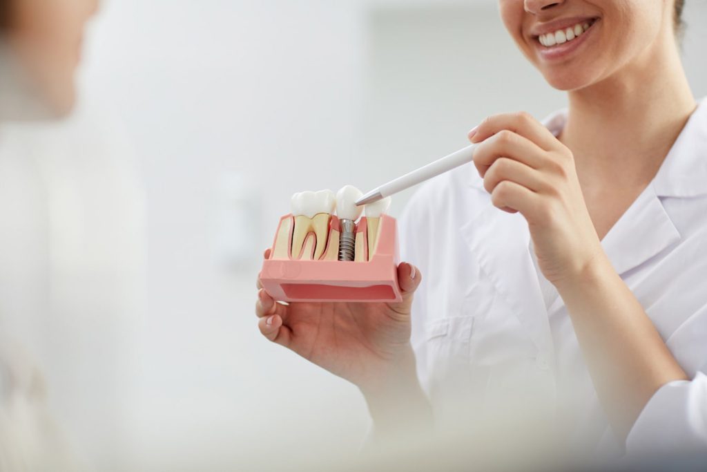 نوآوری در مواد و تکنیک های ساخت ایمپلنت