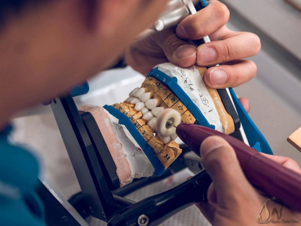 روش های سنتی دندانپزشکی