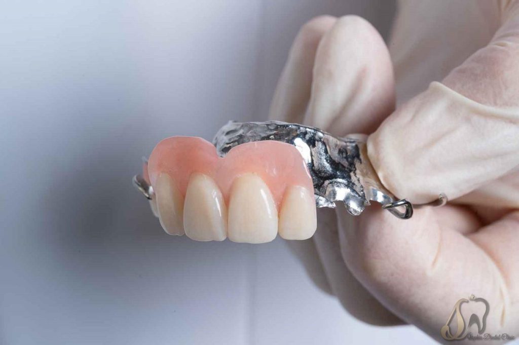 انواع پروتز دندان متحرک