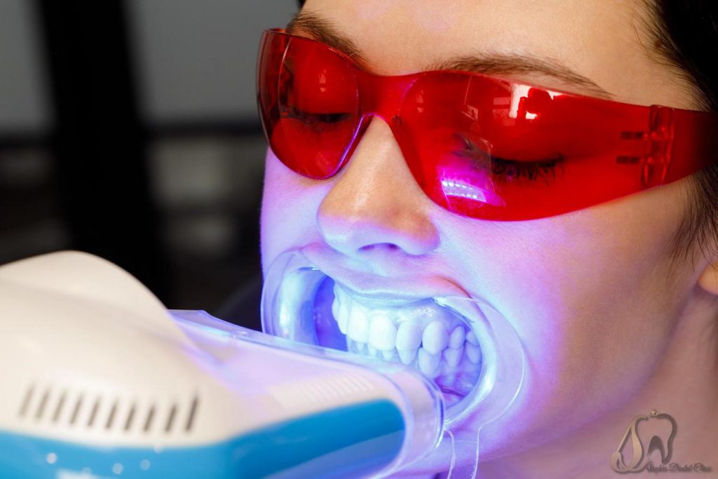 موارد استفاده از لیزر در دندانپزشکی