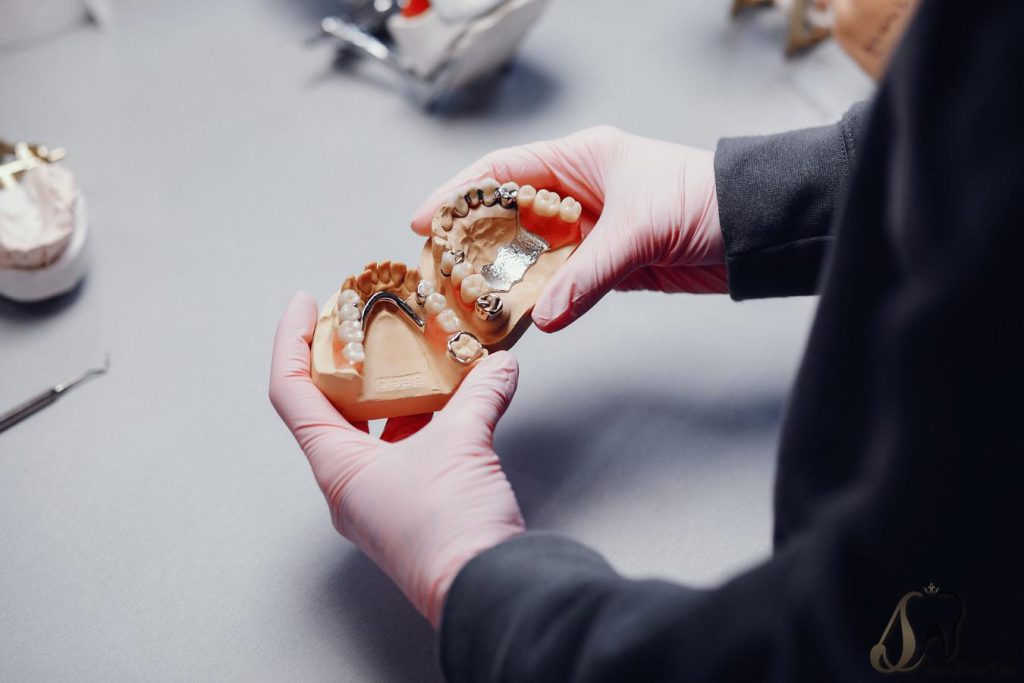 پروتز دندانی چیست؟