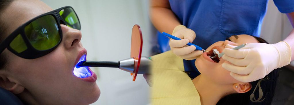 تصویر شاخص مقایسه لیزر دندانپزشکی با روش های سنتی