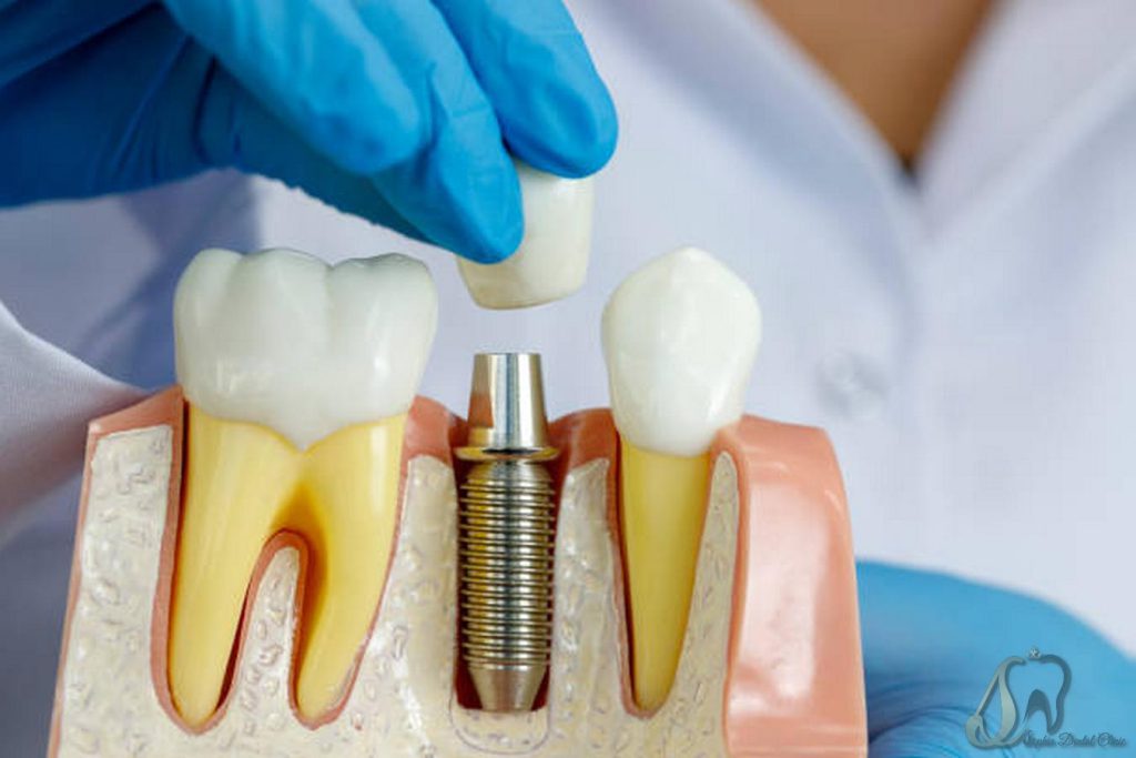 بایگانیهای اخبار و مقالات - کلینیک دندانپزشکی سوفیا