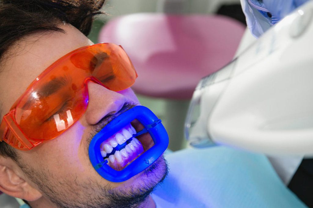 بلیچینگ دندان به چه صورت انجام میشود؟