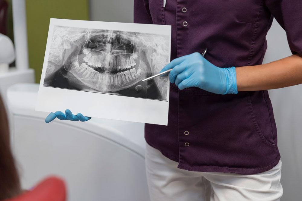 چگونه رادیوگرافی دندان انجام می دهند؟