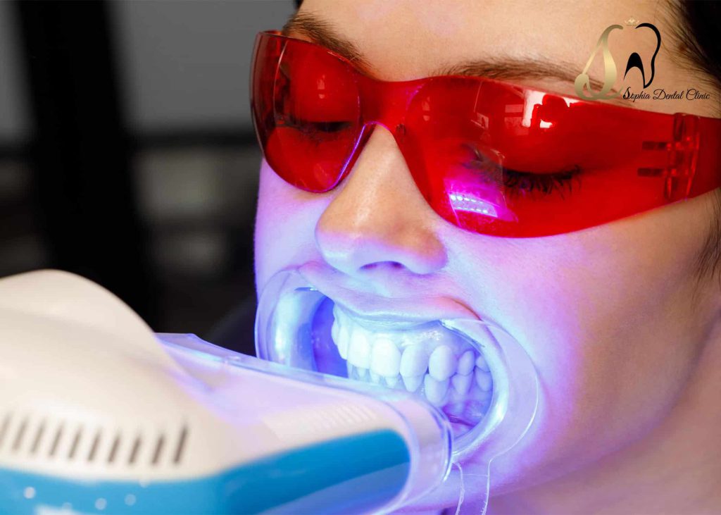 معایب درمان دندانپزشکی چیست؟