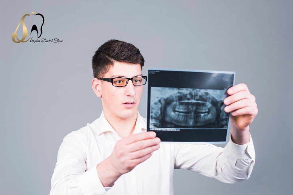 رادیو گرافی دندان چیست؟