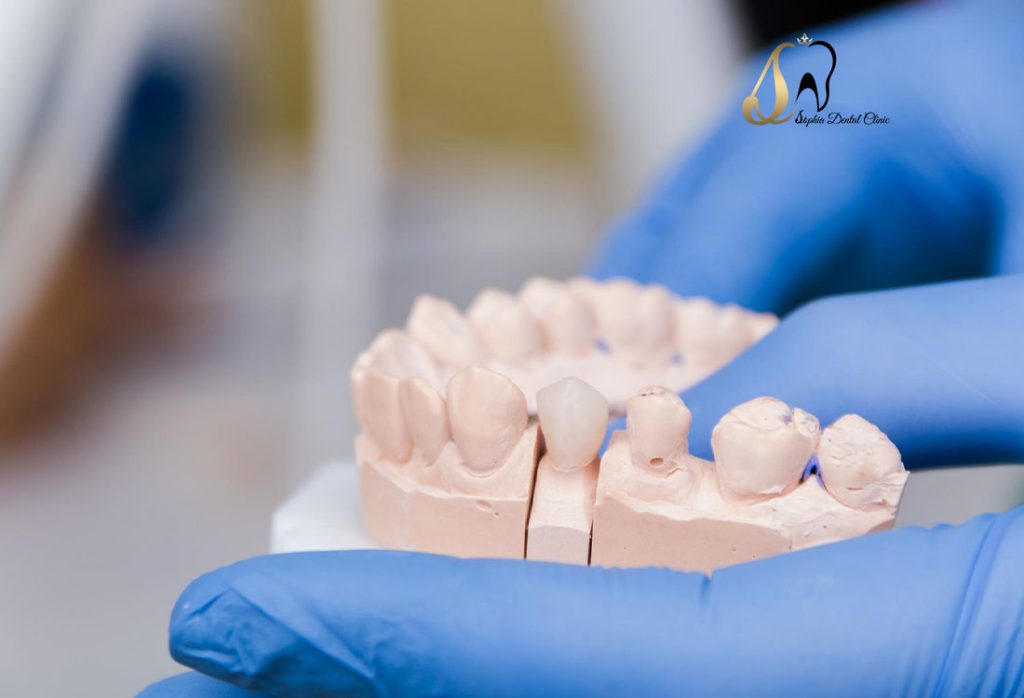 پروتز های دندانی در سالمندان به چه صورت است؟