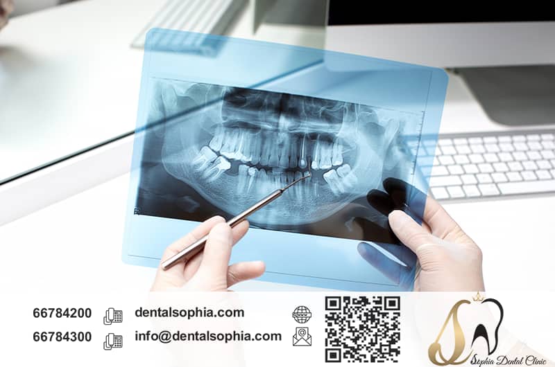 کلینیک تخصصی عصب‌کشی‌ سوفیا در یافت‌آباد 