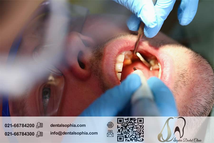 عوارض جراحی دندان و راه‌های پیشگیری از آن‌ها