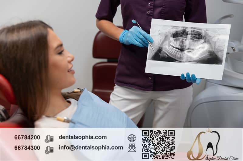 نقش رادیوگرافی در تشخیص زودهنگام پوسیدگی دندان