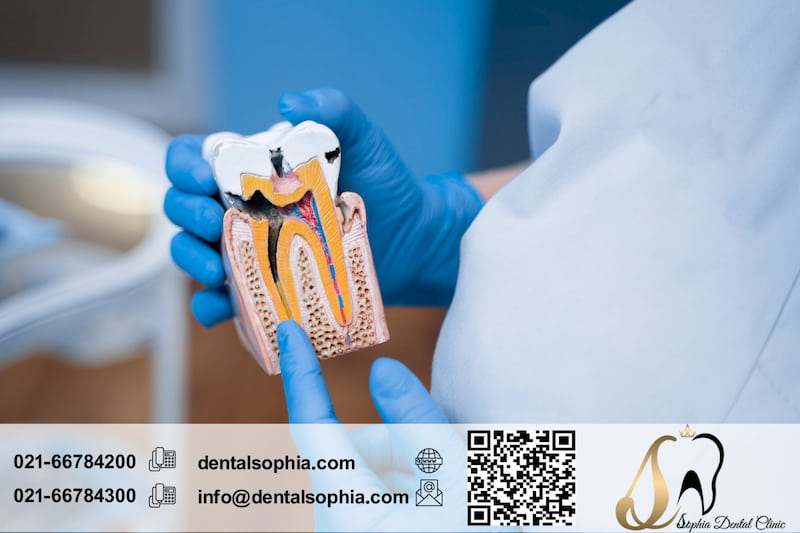 چگونه از پالپ دندان مراقبت کنیم؟