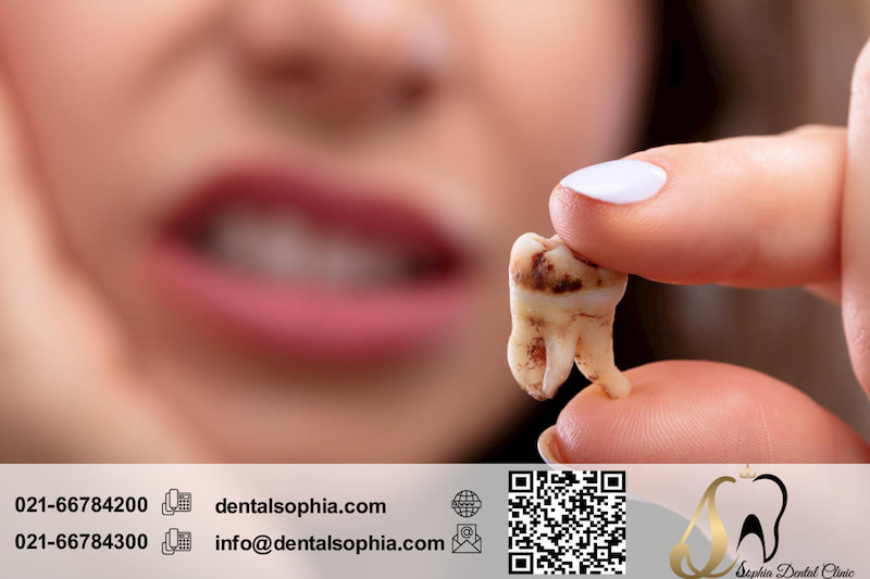 دلایل اصلی نیاز به درمان ریشه دندان