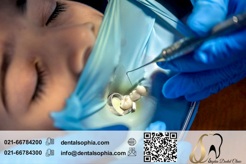 پالپیت برگشت‌پذیر چیست؟